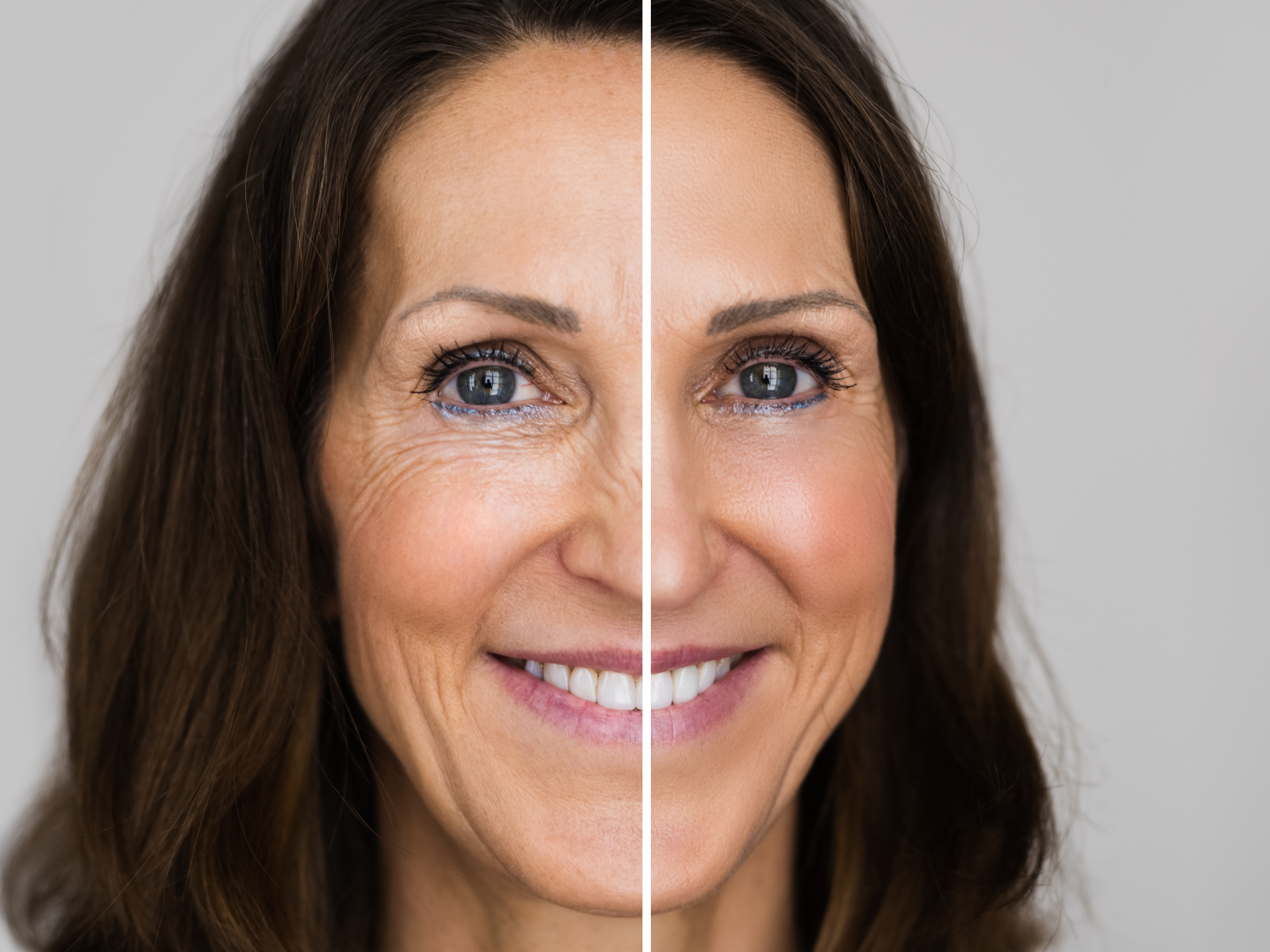 pub Debe Inferior Descubre los mejores tratamientos para el rejuvenecimiento facial sin  cirugía | Harmony & Health